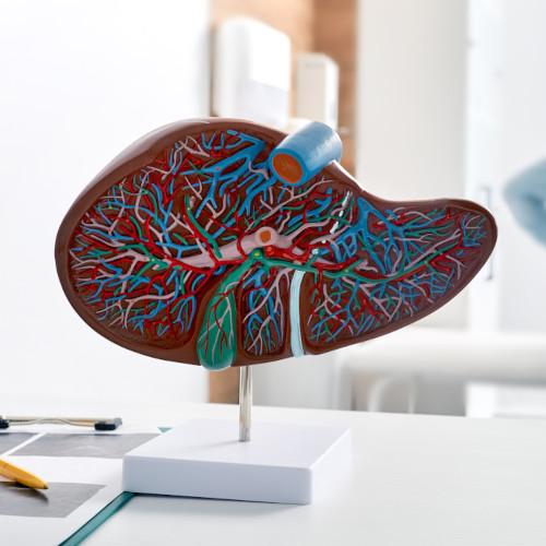intro pic - Hepatitis A 3D plastic model of a liver