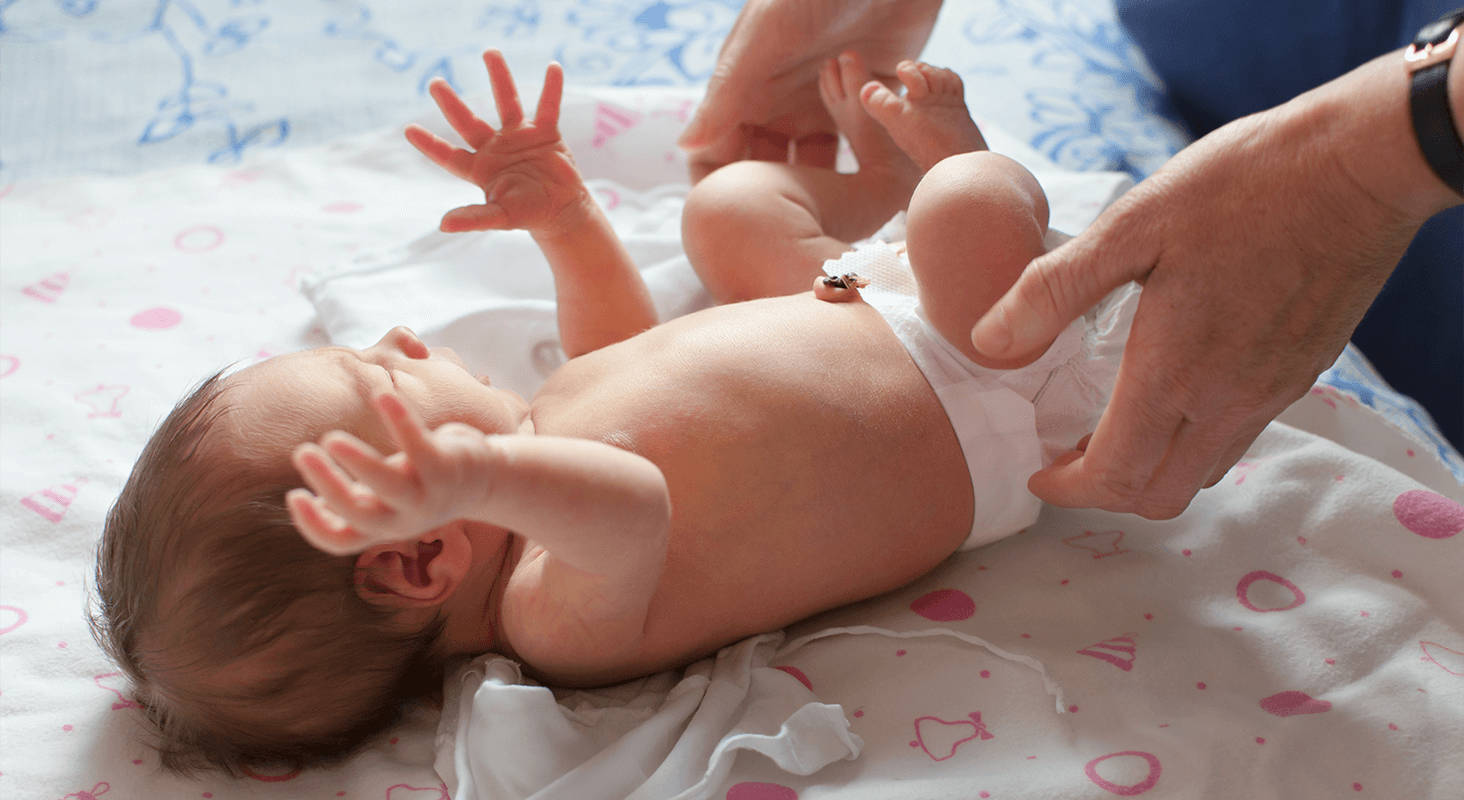 Infant with Umbilical Cord Stump